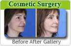 Cosmetic Surgery
